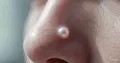 面部皮肤癌是什么样子：症状和照片